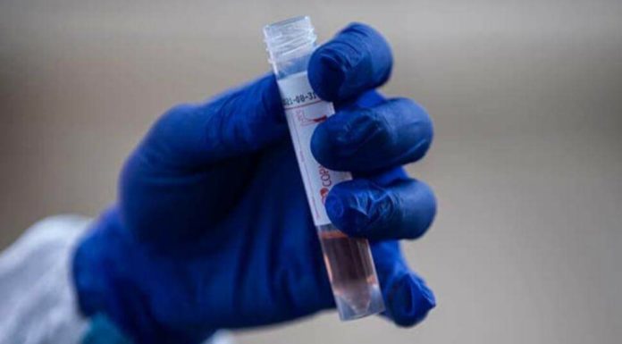 Israel asegura que logró desarrollar un anticuerpo para neutralizar el coronavirus